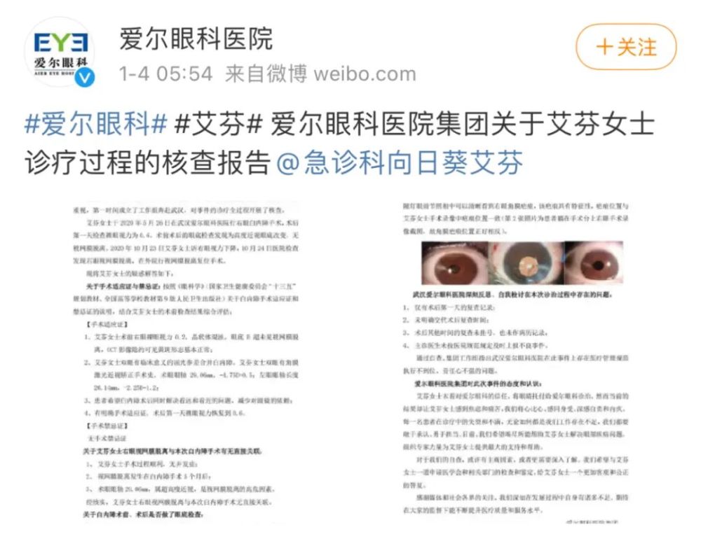 爱尔眼科:艾芬右眼失明与手术无关-WordPress极简博客