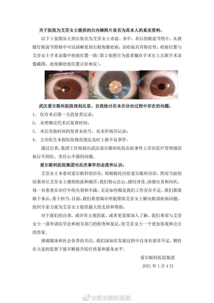 爱尔眼科:艾芬右眼失明与手术无关-WordPress极简博客