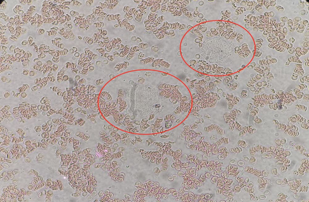 血小板计数镜下图片