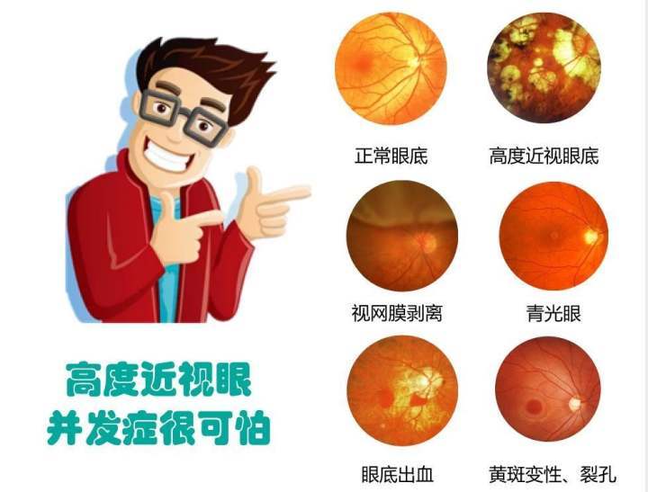 高度近视的他没想到自己得了另外一种眼科疾病更隐蔽危害却更大