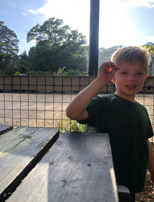 英国奇迹男孩今年4岁了出生时腹部器官长体外