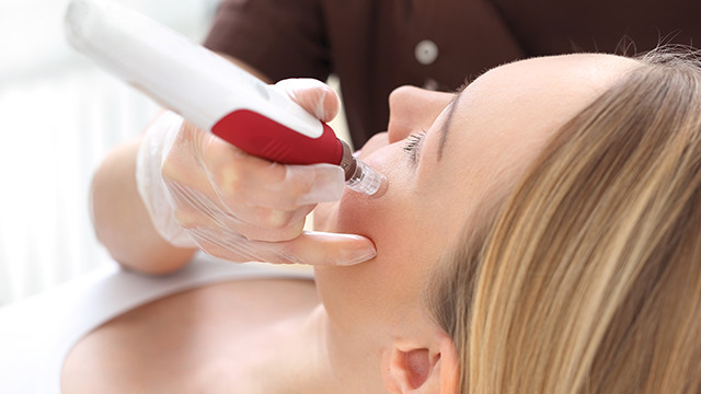 痘坑如何治疗？看看这三种方法，让你远离疤痕烦恼