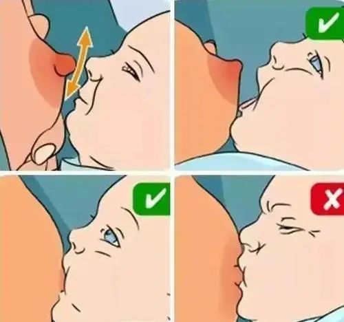 开乳过迟,或哺乳不定时,或哺乳时乳汁不能排空,宝宝含乳姿势不正确