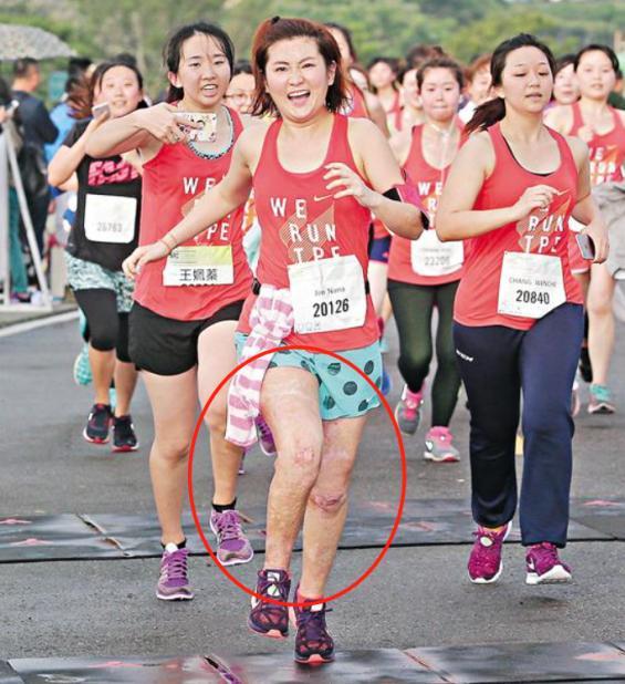 selina素颜脸色苍白,街边吃豆花显凄凉,脚踝大露爆炸伤疤