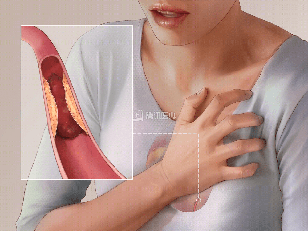 23岁互联网女员工凌晨加班猝死这6个心脏救命信号千万留心