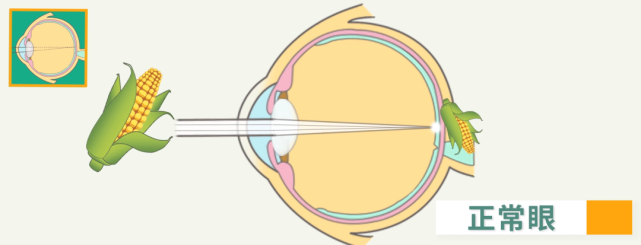 眼睛中的晶狀體就相當於相機的鏡頭,從解剖圖像來看,光線透過鏡頭直射