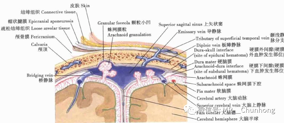 硬膜外与硬膜下出血的血来自哪里 腾讯新闻