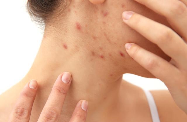 3,眼白发黄,眼睛发干; 4,皮肤起皮,瘙痒; 5,嘴里发干,发苦; 6,营养