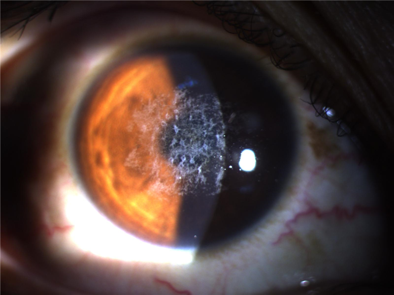 左手医术右手艺术揭密裂隙灯摄影大师的拍摄技巧