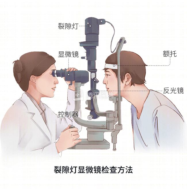 裂隙灯下眼睛图解手绘图片