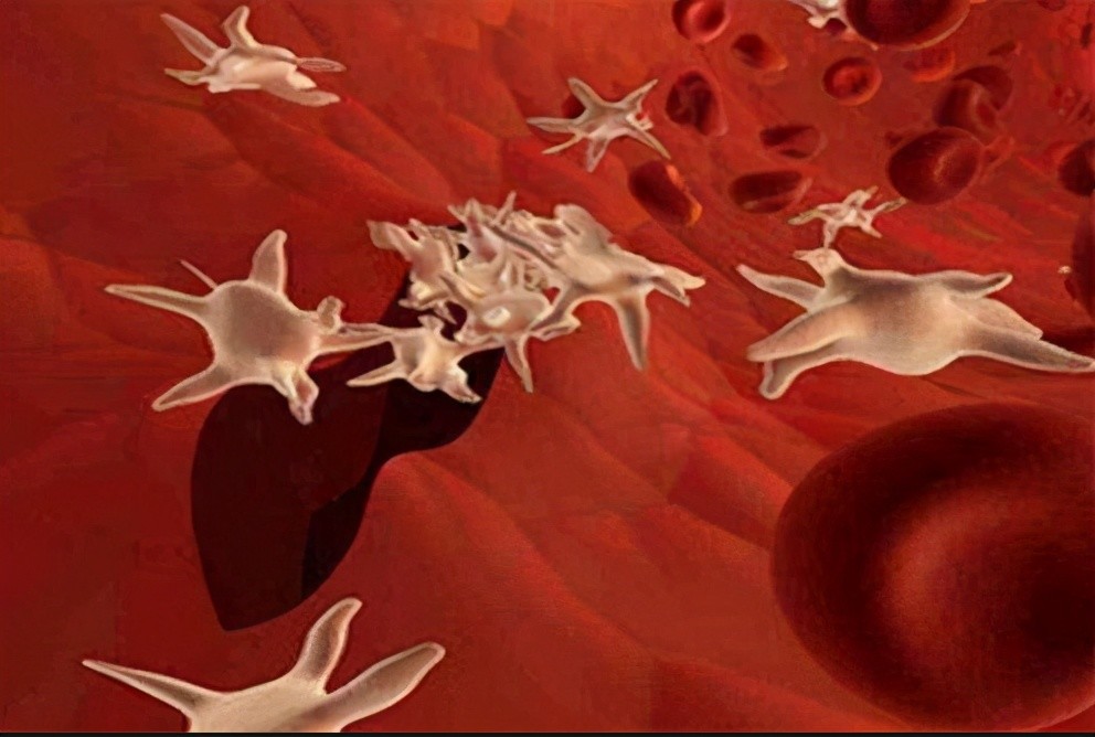 再生障碍性贫血,血小板减少性紫癜或药物也会导致骨髓损坏,还有白血病