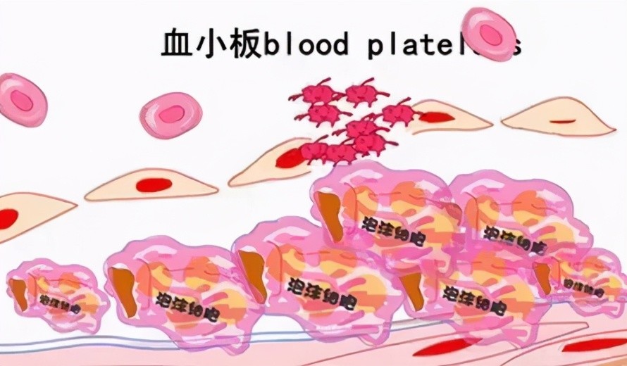 血液病問答:血小板低到多少會有生命危險?_騰訊新聞