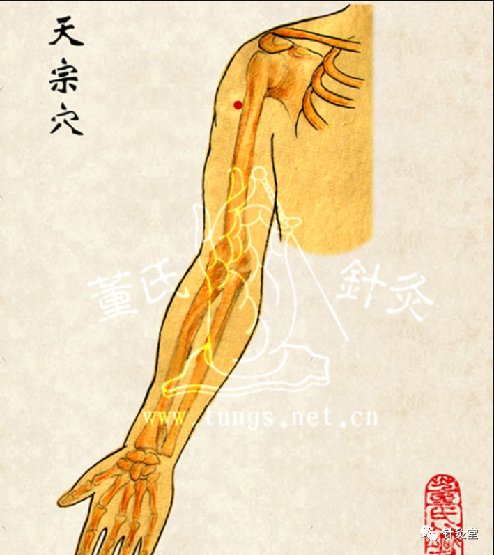 董氏奇穴：天宗穴【穴位讲解】_腾讯新闻