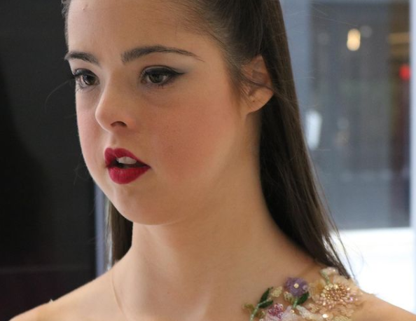 唐氏综合症女孩身高1米6却在模特界大放光彩还登上纽约时装周