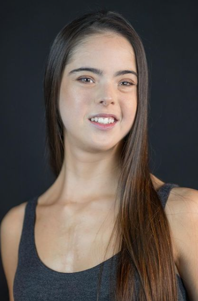 唐氏综合症女孩身高1米6却在模特界大放光彩还登上纽约时装周