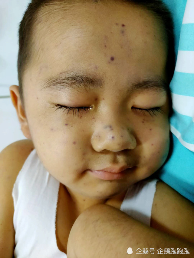 父母双亡一婚不幸二婚嫁长10岁男子儿子又患血癌帮帮她