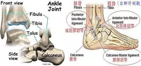 脚踝扭伤了 没有骨折为什么还要打石膏 腾讯新闻