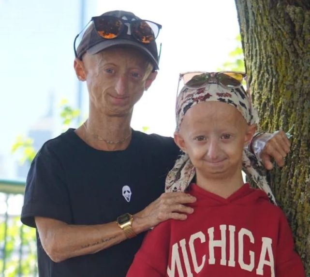 患早衰症必死无疑专家帮忙改基因就能治好