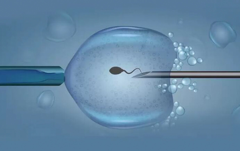 输卵管结核能治好吗可以试管怀孕吗多少钱？