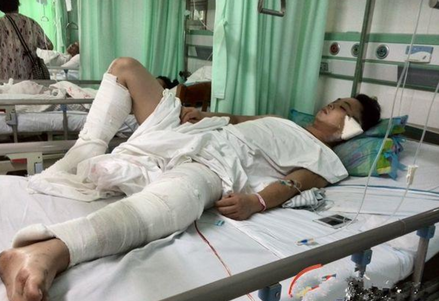 骑摩托撞上轿车,放烟花炸伤自己脸,走路摔成骨折_腾讯新闻