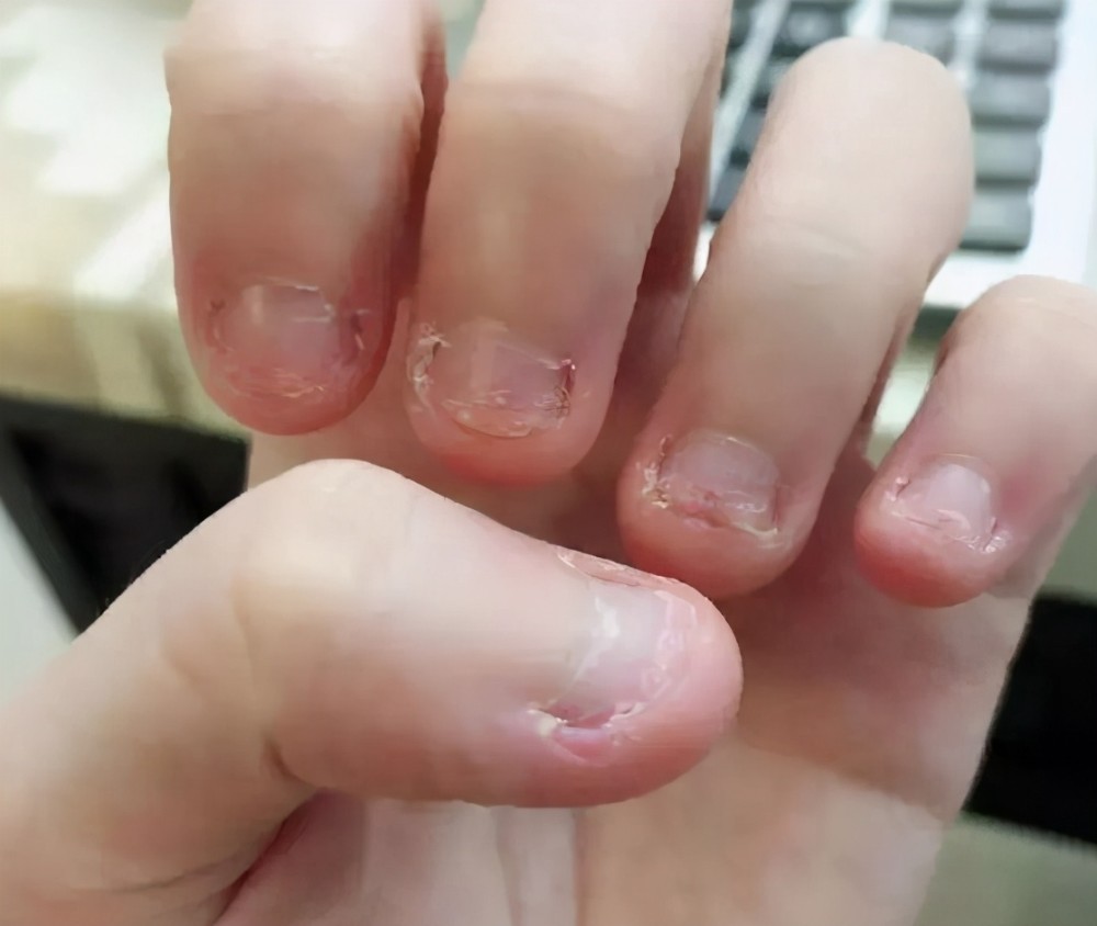 王一博又被拍到啃指甲:长大后仍啃指甲的孩子,大多有两个原因_腾讯