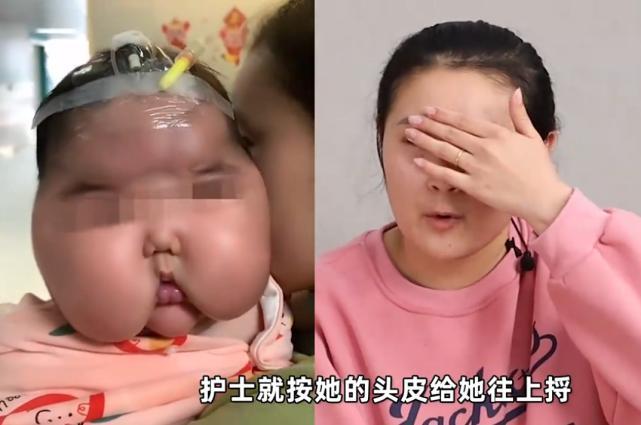 1月7日,有网友爆料一起疑似"大头娃娃"事件——有家长从市面上购买"嗳