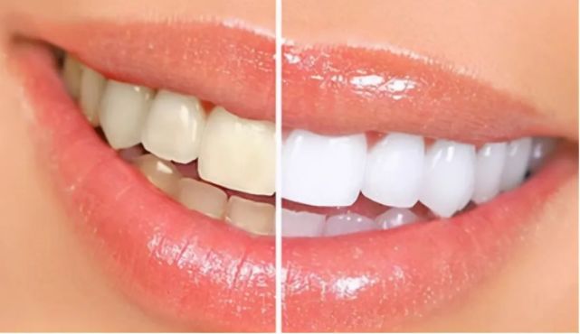 唇红齿白,你都拥有了吗?