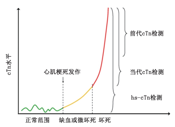 肌鈣蛋白i和t哪種更好高敏肌鈣蛋白有何區別急診心事