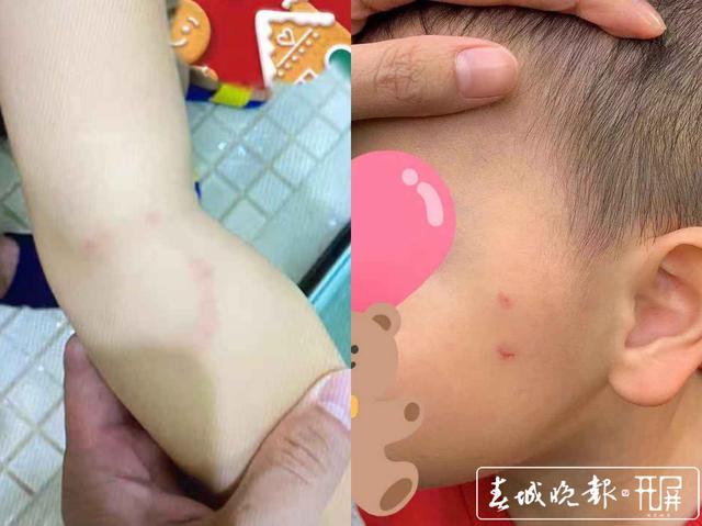 温州贵族幼儿园三岁孩子被外教殴打?校方:断章取义 歪曲事实