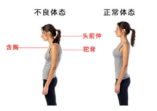 你的站姿对吗