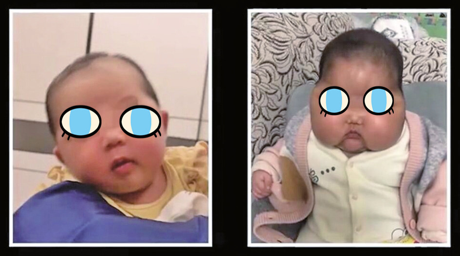 5个月女婴成"大头娃娃",知名博主测出其使用的婴儿霜激素超标