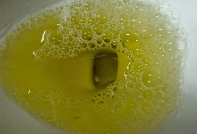 尿液发黄味道很大是怎么回事呢听听医生怎么说