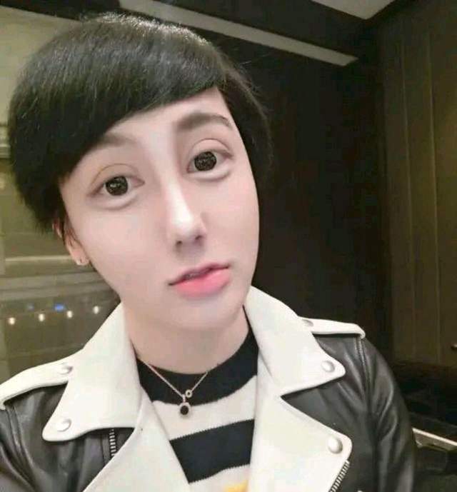 蛇精男刘梓晨自曝感染新冠遭毁容双重打击劝网友戴好口罩