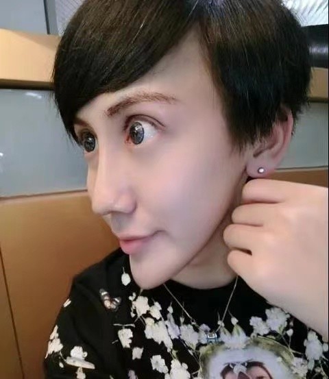 "蛇精男"刘梓晨感染新冠后再发文,神情憔悴地表示:好想回国