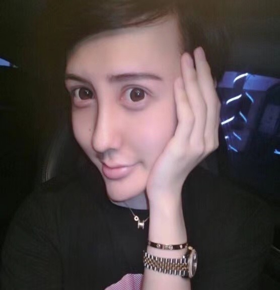 蛇精男刘梓晨感染新冠后再发文神情憔悴地表示好想回国