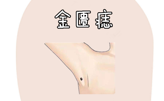 身上有5颗"福禄"痣,祖上有钱,手握财库,个个皇帝命福气大!