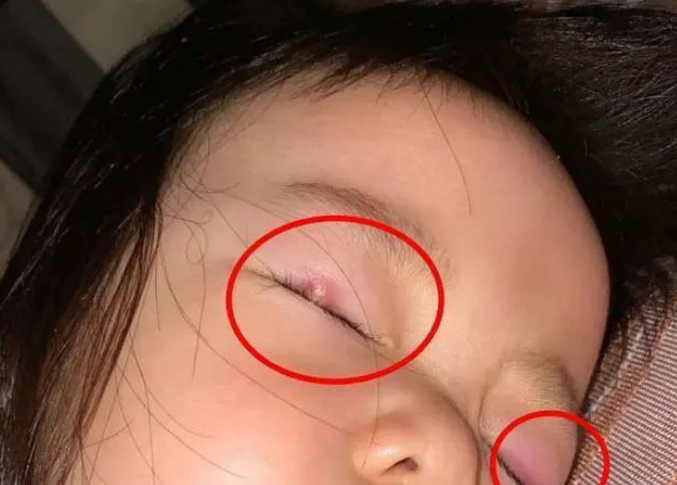 如果孩子眼睛有这4个表现,脾胃八成已"烂如渔网",家长别忽视