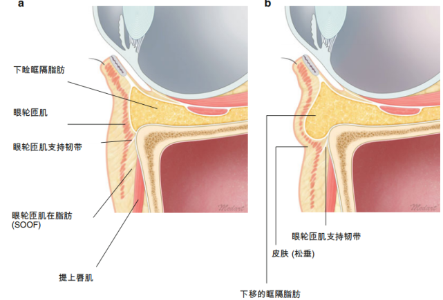 各部位的基本解剖學結構a眼窩凹陷;b臥蠶額部正中矢狀面額部範圍寬廣