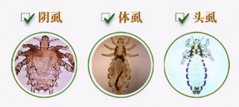 阴虱分化的时间对应体毛退化的时间,因为体毛退化会导致阴虱和头虱