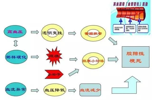 舊版教材概念:腔隙性腦梗死是指在長期高血壓病的基礎上