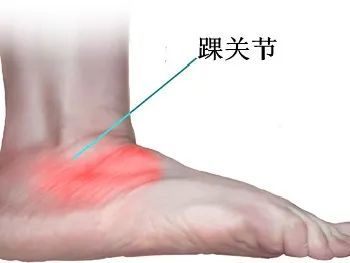 无法行走的痛,踝关节滑膜炎是怎么来的?