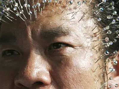 头针会不会扎到脑神经?是如何挥疗效的?治疗效果如何?_腾讯新闻