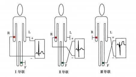 多種不同的心電導聯接法,你掌握了嗎?