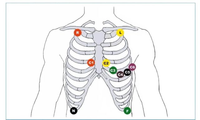 多种不同的心电导联接法,你掌握了吗?