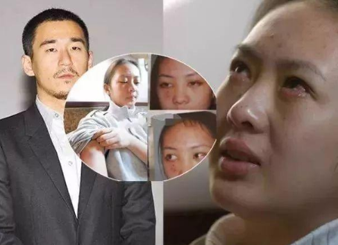 17年前童瑶跪着求张默放过她次年黄定宇被中戏开除