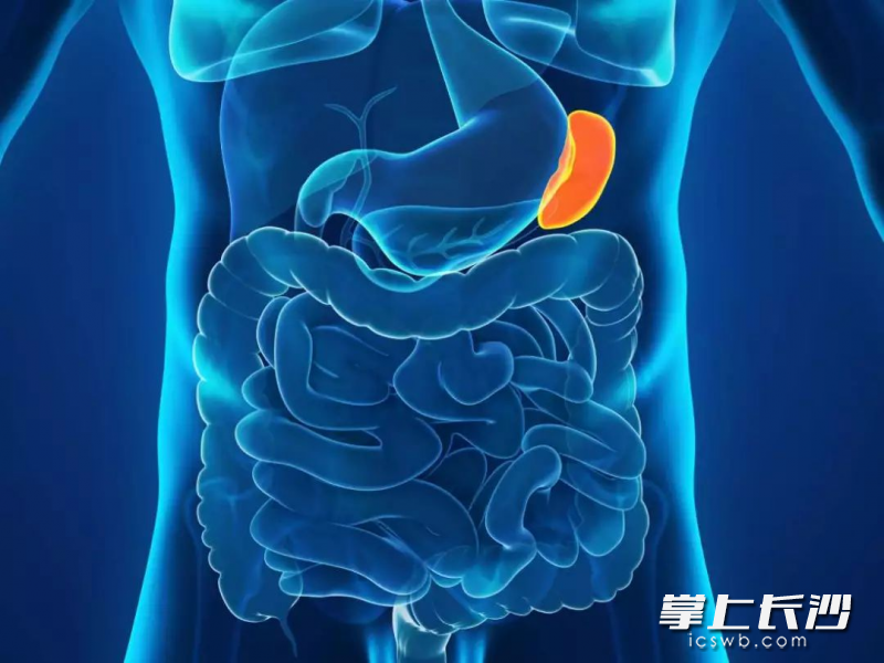 长沙男子无明显诱因左上腹左肩剧烈疼痛一查竟是脾破裂