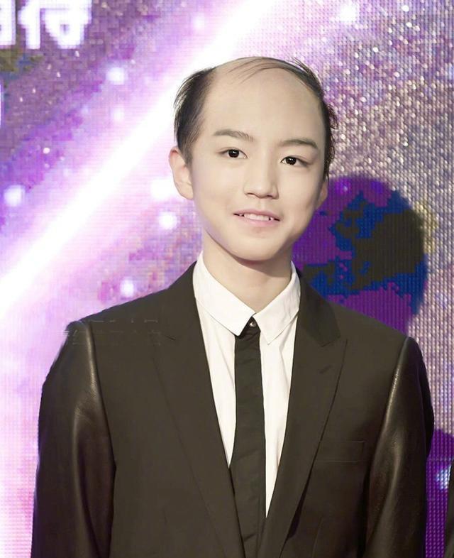 黄晓明秃顶造型曝光撞脸葛优难以认出不比鹿晗张艺兴秃头差