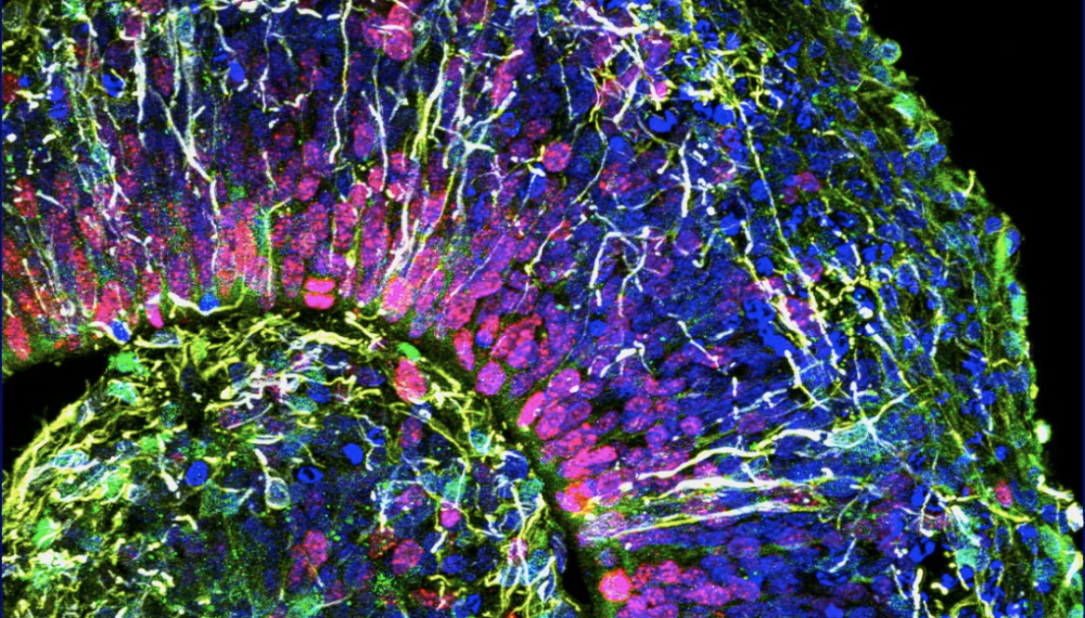 类大脑能帮助神经科学家了解大脑发育但和真实大脑并不完全一致