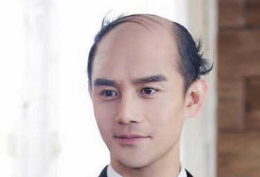 平常他们的造型就是比较精英范儿的那种,没想到"秃头"后,身上还是有一