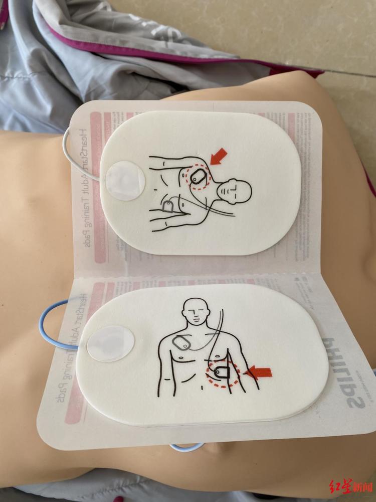 25岁明星疑心梗去世为什么心梗越来越频繁找上年轻人